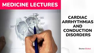 Cardiac Arrhythmias and Conduction Disorders [upl. by Ennairda]