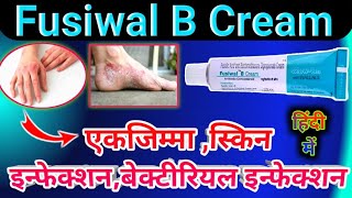 Fusiwal B Cream Uses In Hindi  skin infection ointment  एक दवा 10 काम  स्किन इन्फेक्शन Use [upl. by Tteraj]