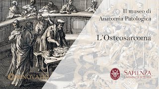 Il Museo di Anatomia Patologica  L Osteosarcoma [upl. by Aenad146]