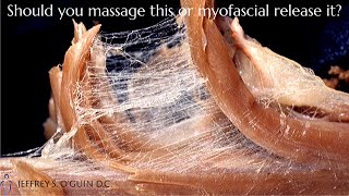 What is myofascial release  Whats the difference between myofascial release vs massage [upl. by Nayrda359]