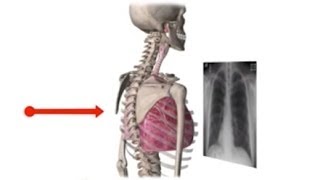 Chest XRay Basics in 5 min [upl. by Boyt]