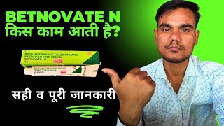 betnovate n lagane se kya hota hai  betnovate n skin cream ke fayde [upl. by Dorren]