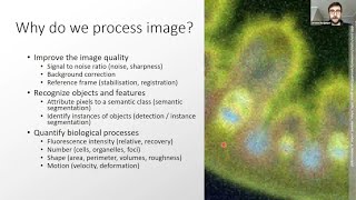 Image Processing for Light Microscopy  Jérôme Boulanger [upl. by Eiliak]