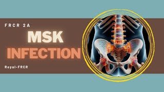 9  MSK amp Trauma Imaging for FRCR [upl. by Iruyas281]