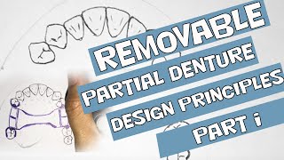 Removable Partial Denture Design Principles Part I [upl. by Jemima]