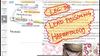 Lead poisoning haematology 35 First Aid USMLE Step 1 in UrduHindi [upl. by Anayaran]