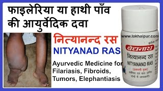 फाइलेरिया या हाथी पाँव की आयुर्वेदिक दवा  Herbal Medicine for Filariasis Lakhaipurtv [upl. by Eladnwahs]