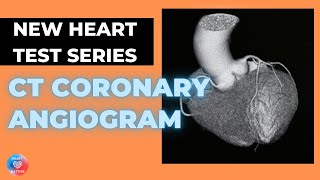 What is a CT Coronary Angiogram  CTCA [upl. by Lamont]