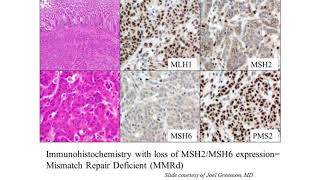 When Why and How to Apply Molecular and Genetic Testing to Colon Polyps and Cancer [upl. by Odin]