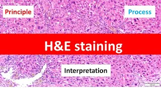 HE Staining Principle Procedure and Interpretation  Haematoxylin and Eosin Staining [upl. by Inilam335]