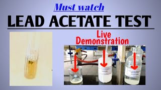 Lead acetate test  Test for sulfur containing amino acids  Biochemistry  NEETPG [upl. by Aruam]