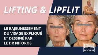 Rajeunissement du visage par lifting et liplift [upl. by Flann127]