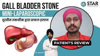 Best Hospital for Gall Bladder Stone in Moga  Best Gall Bladder Doctor  Gall Bladder Treatment [upl. by Hakaber]