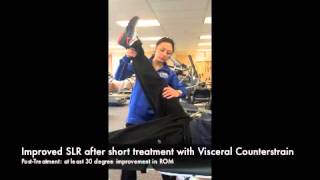 How Visceral Counterstrain can Increase a Straight Leg Raise [upl. by Thetisa234]