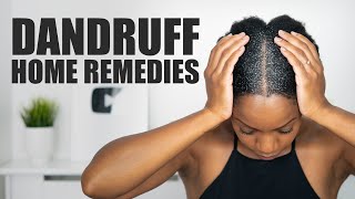 8 HOME REMEDIES to FIGHT DANDRUFF [upl. by Myles325]