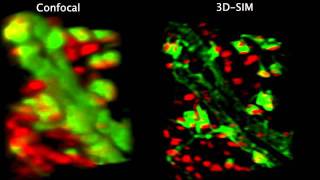 Confocal vs 3D structured illumination [upl. by Madelene592]