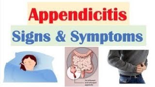 appendicitis [upl. by Azal]