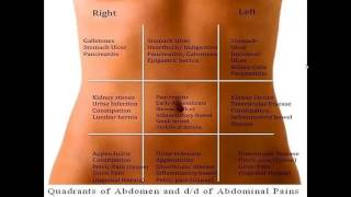 Differential diagnosis of abdominal pain according to abdominal regions [upl. by Brucie]