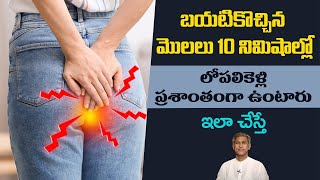 Home Remedies for Piles  Get Rid of Hemorrhoids  Pain Relief  Manthenas Health Tips [upl. by Acina781]