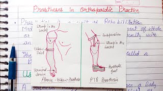 Prosthesis in Orthopaedic Practice  uses parts of prosthesis [upl. by Utley803]