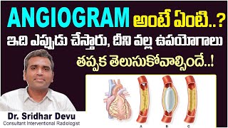 Angiogram వల్ల ఉపయోగాలు  What is Angiogram  Procedure and Benefits of Angiogram  Dr Devu [upl. by Nivert56]