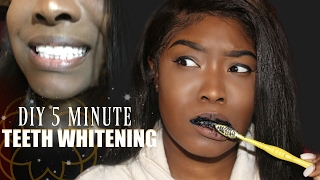 5 MINUTE TEETH WHITENING  DIY CHARCOAL TOOTHPASTE [upl. by Aletsirc227]