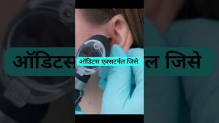 Otitis externamedicine healthtips physiologyhealth healthcaresymptoms treatmentotitis [upl. by Henriques]