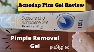 PRODUCT REVIEWEPI23ACNEDAP PLUS GEL REVIEWDAPSANE amp ADAPALENE GEL REVIEWPIMPLE REMOVAL GELACNE [upl. by Pilloff833]