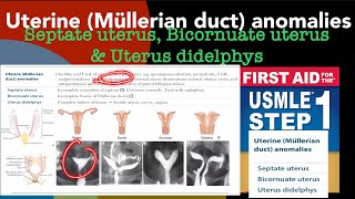 Uterine Mullerian duct anomalies Septate uterus Bicornuate uterus amp Uterus didelphys [upl. by Yraillih980]