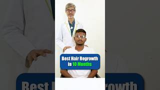 100 Hair Regrowth in Just 10 Months  Adon Hair Care  Testimonial  Hair Expert  Hair Loss viral [upl. by Jovi]