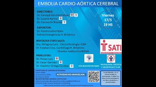 WEBINAR EMBOLIA CARDIOAORTICA CEREBRAL [upl. by Eerak]