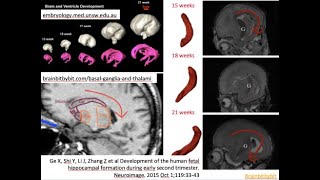 78 Deep structures of the forebrain embryology thalamus hypothalamus striate hippocampus [upl. by Ki600]