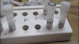 ODD methodOuchterlony Double diffusion practical method [upl. by Gibe576]