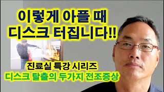 이렇게 아플 때 디스크 터집니다 디스크 탈출의 두가지 전조증상 [upl. by Rufford951]