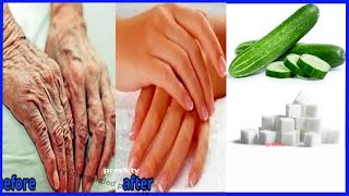 Cucumber anti wrinkle home remedies remove wrinkles from Hands in 5 days  hand wrinkles home remedy [upl. by Nyltiac]