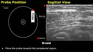 Breast Ultrasound Probe Positioning  Sagittal Radial Views amp Clock System USG Transducer Placement [upl. by Anowahs977]