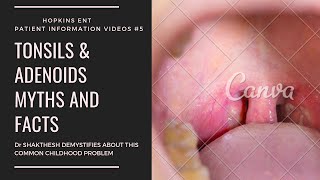 TONSIL AND ADENOID SURGERY MYTHS AND FACTS I TAMIL VERSION I PART 1 [upl. by Aicnerolf]