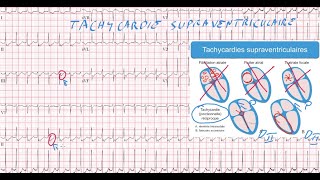 20 ECG  Quiz  Dr Synapse [upl. by Swart]