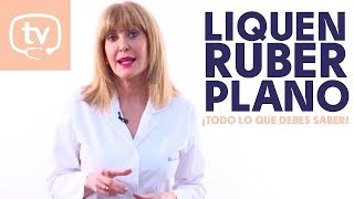 Liquen ruber plano ¿qué es y cómo tratarlo [upl. by Aelanej]