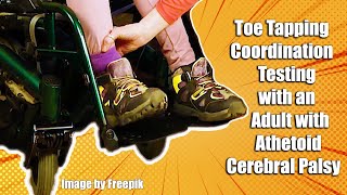 Toe Tapping Coordination Testing with an Adult with Athetoid Cerebral Palsy 7 [upl. by Bridge873]