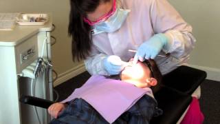 Silver Nitrate  Fluoride Varish Protocol [upl. by Marylynne482]