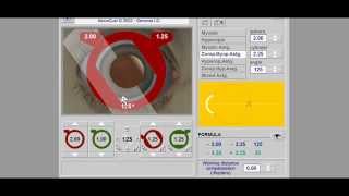 Retinoscopy Simulator Tutorial  Retinoscopy part 2 [upl. by Werner]