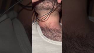 hairsalon hairandbeard hair hairstyle barbersurgion beard hairremoval bearding skincare [upl. by Nortyad596]