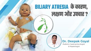 Biliary Atresia के कारण लक्षण और उपचार  Biliary Atresia Baby  Dr Deepak Goyal [upl. by Swan]