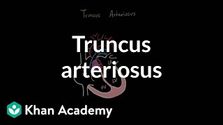 Truncus arteriosu  Circulatory System and Disease  NCLEXRN  Khan Academy [upl. by Aronas]