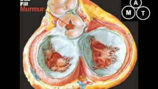 Animated Aortic Regurgitation Murmur [upl. by Bardo]