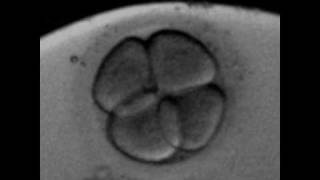 Rotation of the blastomeres at 4cells human embryoavi [upl. by Knutson]