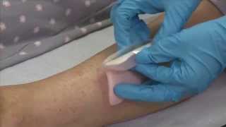 ALLEVYN Adhesive application to the leg [upl. by Hernando]