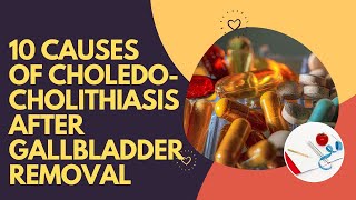 10 Causes Of Choledocholithiasis After Gallbladder Removal [upl. by Ezara108]