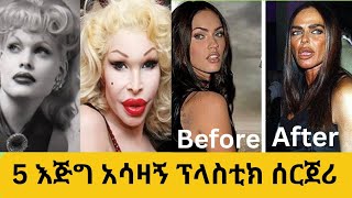 5 እጅግ አሳዛኝ ፕላስቲክ ሰርጀሪThe Dark Side of Plastic Surgery Gone Wrong [upl. by Ynnij]